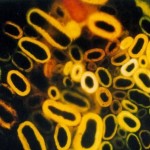 zdjęcie mikroskopowe. na czarnym tle, jasno żółte cylindryczne kształty z czarnym środkiem